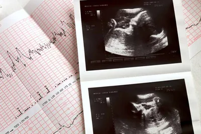 Director of women’s clinic: Abortion pill reversal is safe and effective