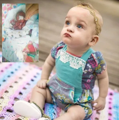 Parents Praise God as 'Miracle' Daughter Born at 21 Weeks Celebrates First Birthday