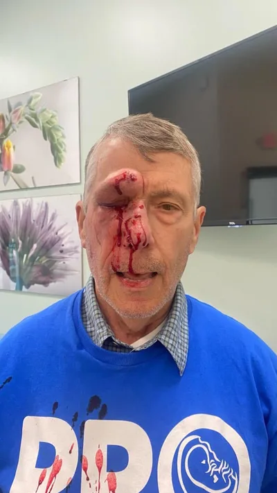 Pro-Life Activists Assaulted Outside Maryland Abortion Clinic, Suspect Remains at Large