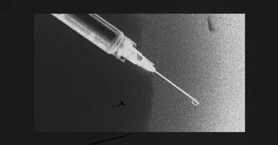 Euthanizing a Toddler Is Not Compassionate