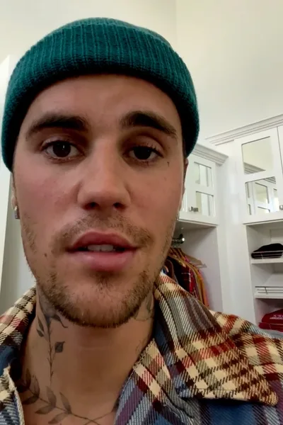 'I trust God,' says Justin Bieber after revealing facial paralysis