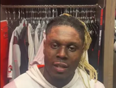Cleveland Browns Player Gives 'all the glory to God' after Surviving Burn Injuries to Face
