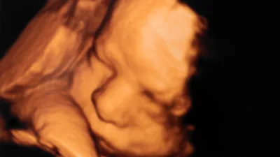 Israeli Pro-Life Group Petitions High Court to Save the Unborn in a Nation Where Abortion is Widely Accepted