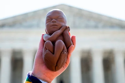 Abortion was the Leading Cause of Death Worldwide in 2023