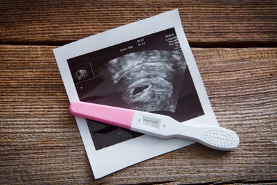 FIRST-PERSON: How your church can serve pregnancy resource centers | Baptist Press