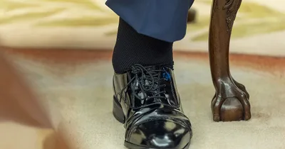 Trump Diagnosed with Common Vein Condition