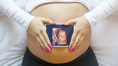 Court Rules Texas Heartbeat Law Can Remain in Place While Litigation Continues