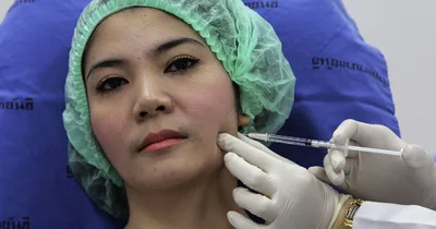 Botox vendors hocking misbranded products, FDA warns