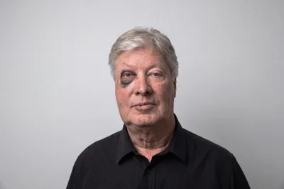 Former Gateway Pastor Robert Morris’ Sex Offender Registry Photo Shows a Black Eye