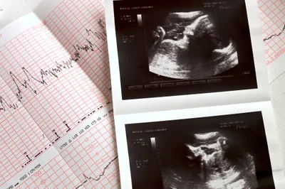 ERLC focuses on potential overturn of Roe vs. Wade | Baptist Press