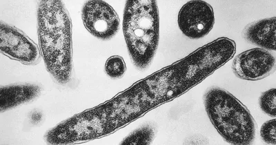 Six Die, 111 Infected in NYC Legionnaires’ Outbreak