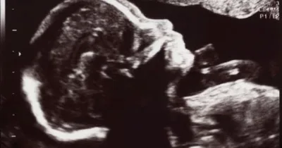 Texas, Biden administration square off over "life-saving" abortions in federal court