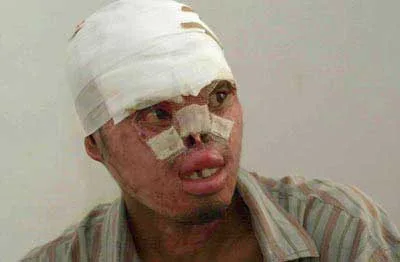 Eyewitness in Ambon, Indonesia: Christians still suffering, dying | Baptist Press