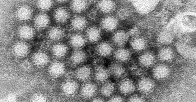 Norovirus outbreaks spiking in some states, CDC says