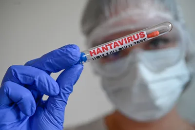 Hantavirus cruise outbreak: 5 critical facts you need to know