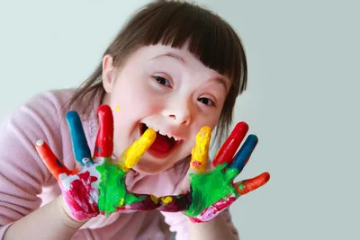 FIRST-PERSON: 3 steps for welcoming kids with special needs to VBS | Baptist Press