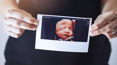 GOP-Controlled Arizona Senate Passes 15-Week Abortion Ban