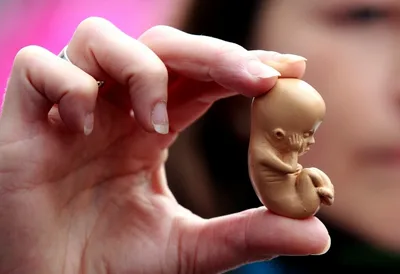 Why abortion is a Gospel issue