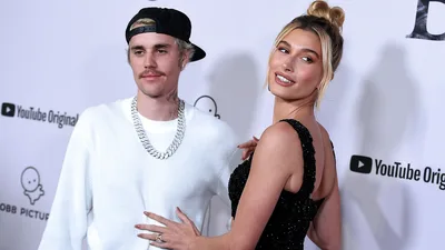 Model Hailey Bieber Says She's Fine After Blood Clot in Her Brain