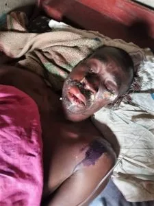 Pastor Sprayed with Acid in Ambush in Kampala, Uganda - Morningstar News