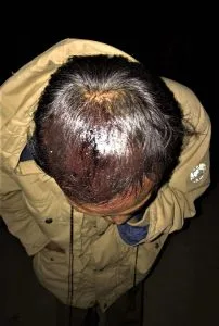 Six Christians Injured in Stoning of Christmas Service in Burma - Morningstar News