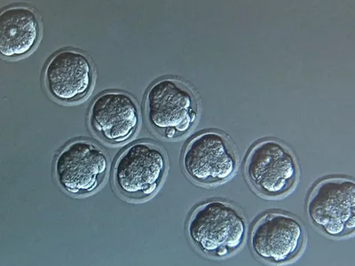 Israeli Biotech Firm Plans to Create Human Embryos to Harvest Organs, Field Experts Say There are Ethical Concerns
