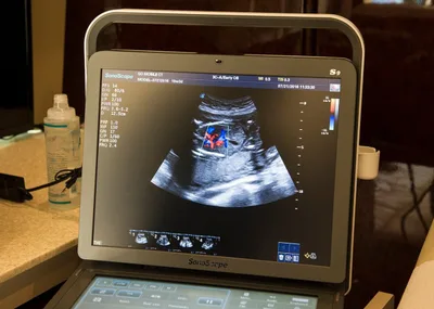 Doctors: Advances since Roe confirm abortion ‘takes life of unborn child’