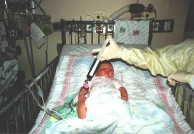 Mom held her 'bubble girl,' wondering if she would die | Baptist Press