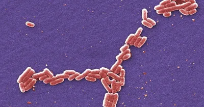 FBI Charges Chinese Researcher for E. Coli Smuggling