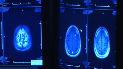 'I Was Very Broken': Pentagon Addresses Traumatic Brain Injury, the Unseen Wound of War