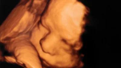 More GOP-Led States Enact Abortion 'Trigger Laws'