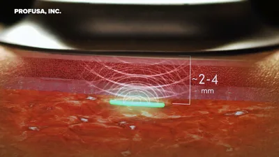 Defense Dept. Develops Next Gen Sensor to Implant Under Human Skin, Like a 'Check Engine Light'
