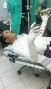 Woman in Yemen Burned to Death for Her Faith - Morningstar News