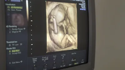 Lawmakers Blast American College of OB-GYNs for Canceling Pro-Life Doctors: 'Always a Bad Idea'