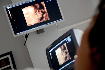 UK pro-life leaders welcome end of ‘DIY home abortions’ in England