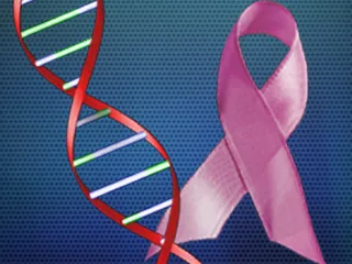 Israeli Scientists Hopeful for New Treatment to Fight Secondary Cancer