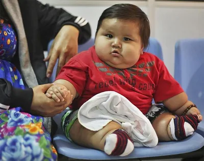 We Must Fight the Obesity Epidemic among Our Children