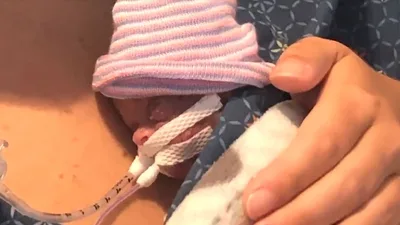 'Nothing Short of a Miracle': How This 22-Week, 11-Ounce Micro-Preemie Finally Made It Home