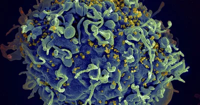 Judge says military can’t reject HIV-positive recruits
