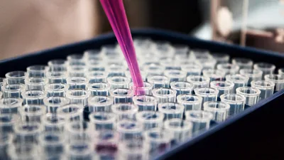 U.S. Presses Moscow for Answers After Mysterious Death at Russian Pathogen Lab | CBN