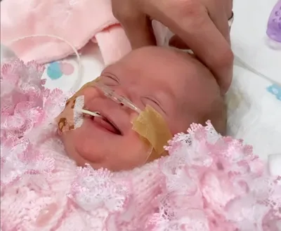 'I Prayed': Doctors Gave Premature Twins a Zero Chance of Survival and Now They're Thriving and Inspiring the World