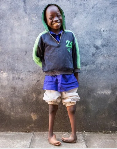 How we can kick Clubfoot for good