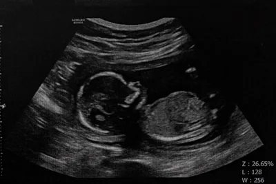What Kind of Civilized Nation Allows Babies to Be Dismembered?