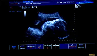 Calls for Clinic's Closure Grow after Abortion Death