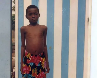 When I nearly died from malaria