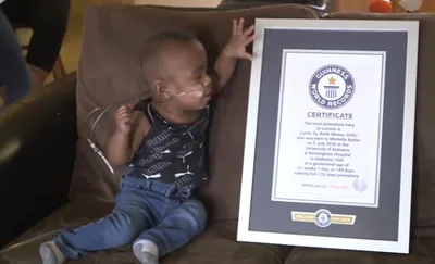 Infant born at 21 weeks breaks Guinness world record for most premature baby to survive