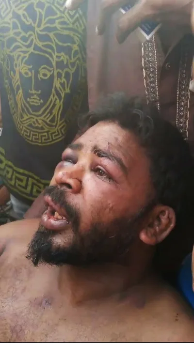 Christian sanitation worker tortured in Pakistan