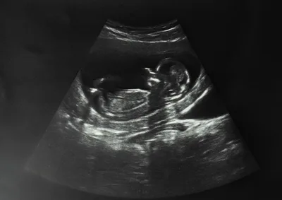 Sorrow over 10,135,618 Lives Lost Since 1967 Abortion Act Came into Effect