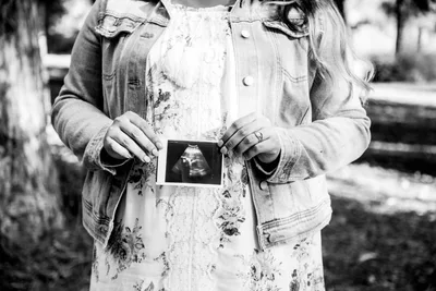 'God Knew Exactly What He Was Doing': She Was Scheduled to Abort Her Baby When an Ultrasound Tech's Simple Question Changed Everything
