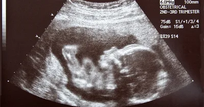 Pro-Abortion Measures Pass in 7 of 10 States with Ballot Initiatives